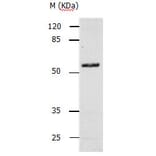 CASP10 Antibody from Signalway Antibody (31137) - Antibodies.com
