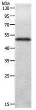 Gel: 10% SDS-PAGE Lysate: 40 µg Human liver cancer tissue lysate  Primary antibody: 1/300 dilution Secondary antibody: Goat anti Rabbit IgG - H&L (HRP) at 1/10000 dilution Exposure time: 2 minutes