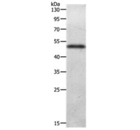 ADIPOQ Antibody from Signalway Antibody (31141) - Antibodies.com