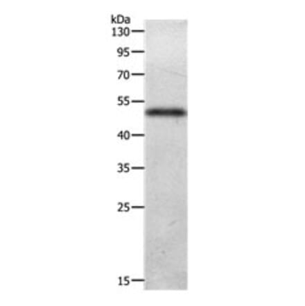 ADIPOQ Antibody from Signalway Antibody (31141) - Antibodies.com