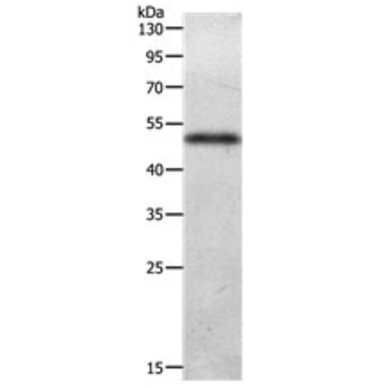 ADIPOQ Antibody from Signalway Antibody (31141) - Antibodies.com