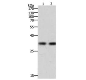 HAVCR1 Antibody from Signalway Antibody (31156) - Antibodies.com