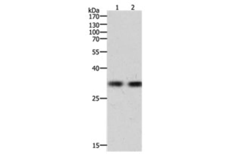 HAVCR1 Antibody from Signalway Antibody (31156) - Antibodies.com