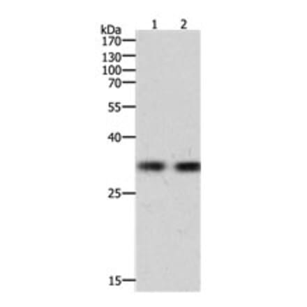 HAVCR1 Antibody from Signalway Antibody (31156) - Antibodies.com