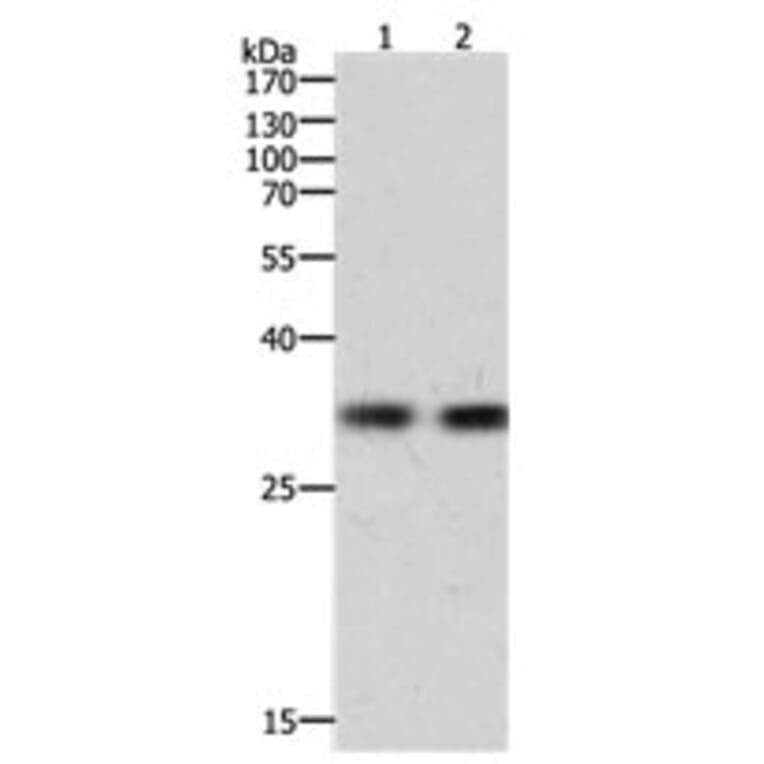 HAVCR1 Antibody from Signalway Antibody (31156) - Antibodies.com