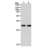 HAVCR1 Antibody from Signalway Antibody (31156) - Antibodies.com