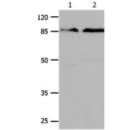 CTNNB1 Antibody from Signalway Antibody (31164) - Antibodies.com