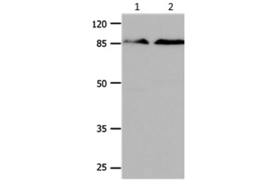 CTNNB1 Antibody from Signalway Antibody (31164) - Antibodies.com