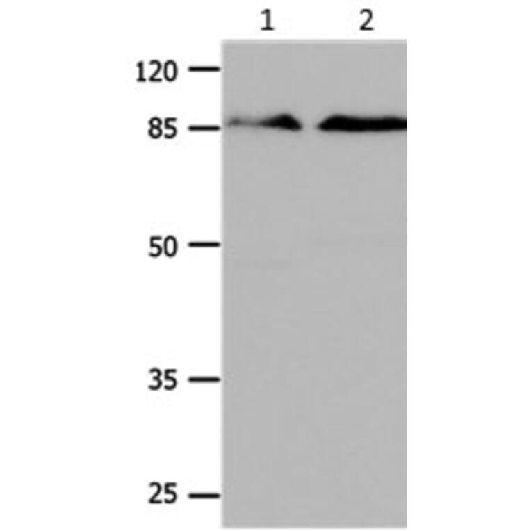 CTNNB1 Antibody from Signalway Antibody (31164) - Antibodies.com