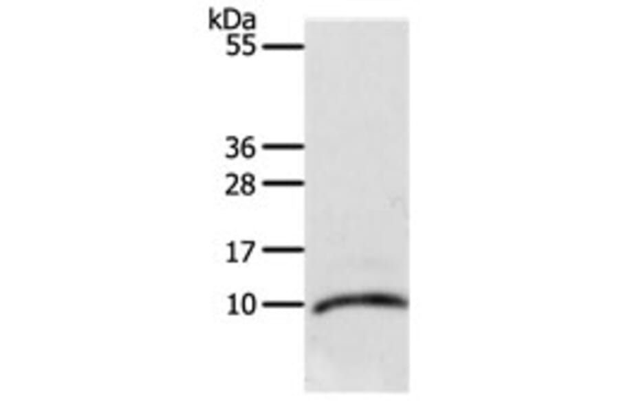 CCL3L1 Antibody from Signalway Antibody (31166) - Antibodies.com