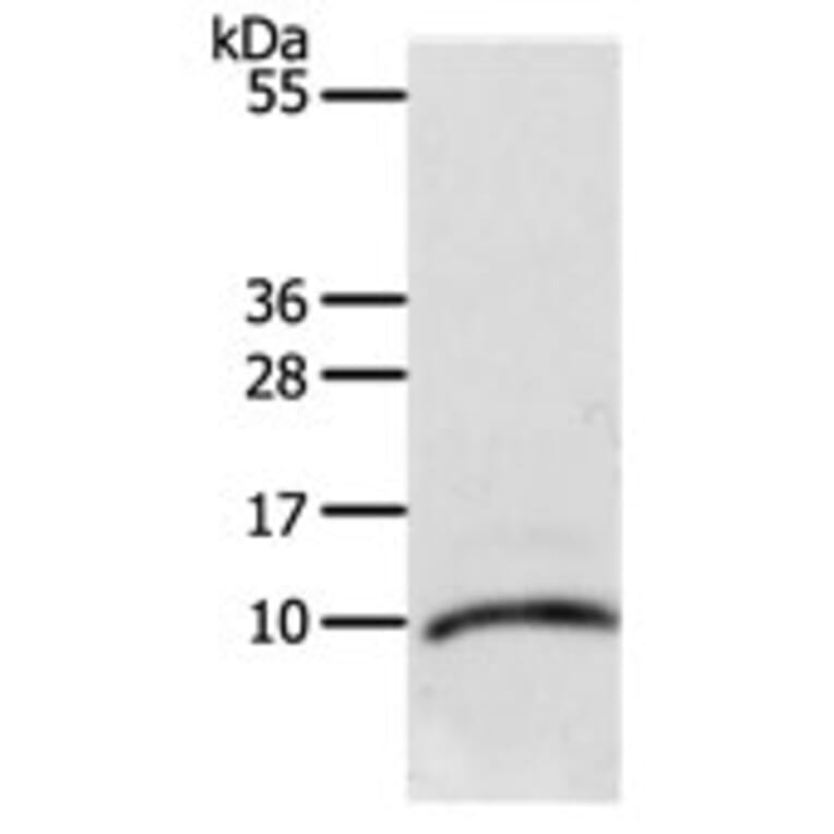 CCL3L1 Antibody from Signalway Antibody (31166) - Antibodies.com