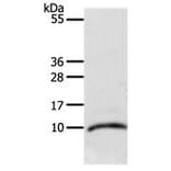 CCL3L1 Antibody from Signalway Antibody (31166) - Antibodies.com