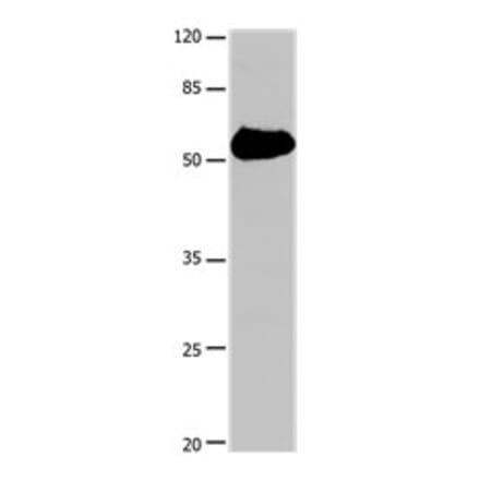 SLC1A1 Antibody from Signalway Antibody (31187) - Antibodies.com