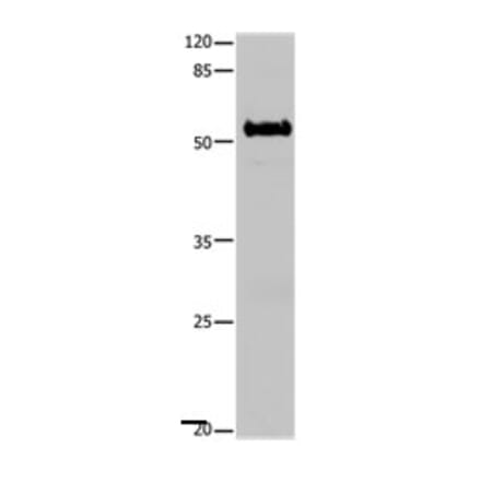 SLC1A6 Antibody from Signalway Antibody (31188) - Antibodies.com