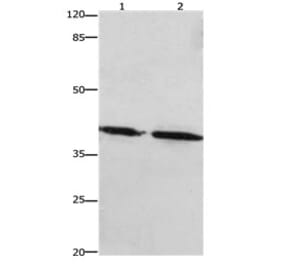 PTGER1 Antibody from Signalway Antibody (31193) - Antibodies.com