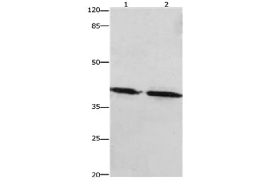 PTGER1 Antibody from Signalway Antibody (31193) - Antibodies.com