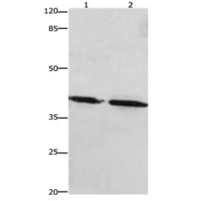 PTGER1 Antibody from Signalway Antibody (31193) - Antibodies.com