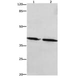 PTGER1 Antibody from Signalway Antibody (31193) - Antibodies.com