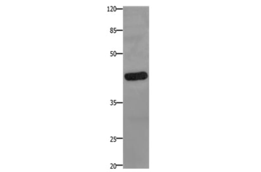 PTGER2 Antibody from Signalway Antibody (31194) - Antibodies.com
