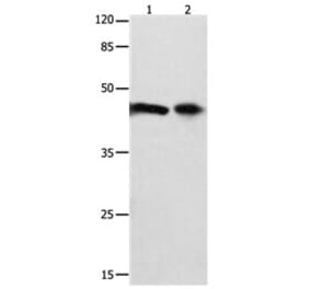 FOXL1 Antibody from Signalway Antibody (31198) - Antibodies.com