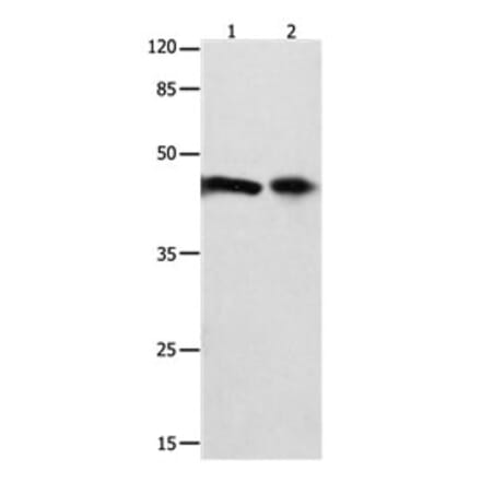 FOXL1 Antibody from Signalway Antibody (31198) - Antibodies.com