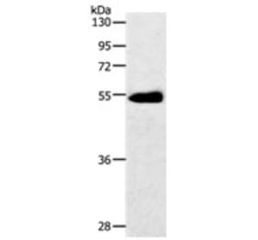 SLC2A3 Antibody from Signalway Antibody (31209) - Antibodies.com