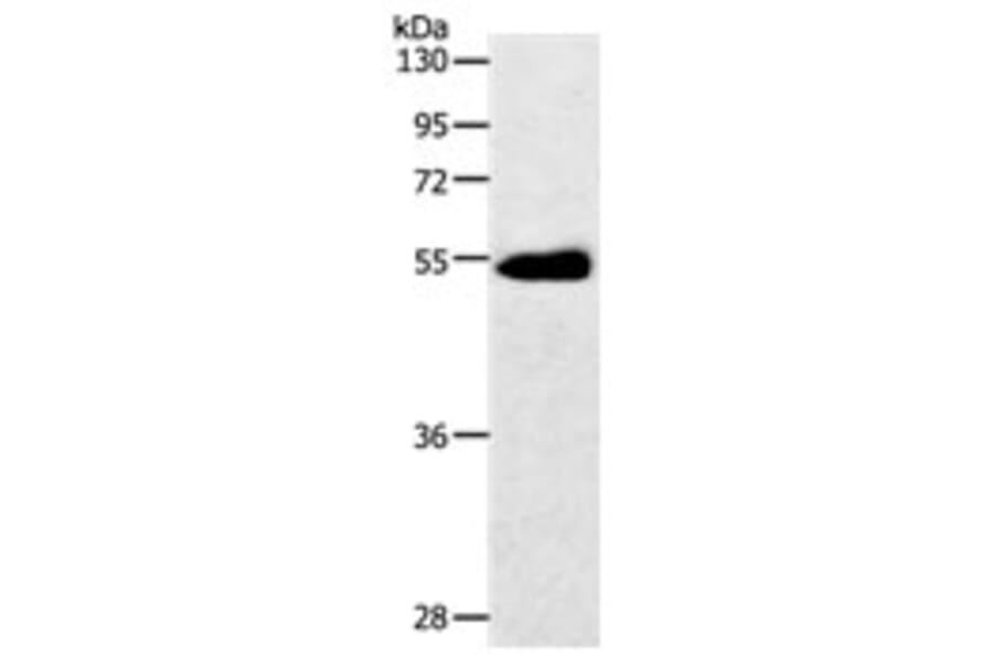 SLC2A3 Antibody from Signalway Antibody (31209) - Antibodies.com