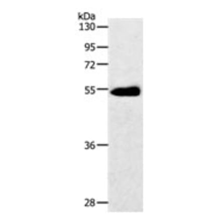 SLC2A3 Antibody from Signalway Antibody (31209) - Antibodies.com