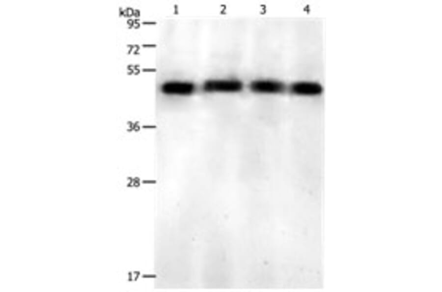 KISS1R Antibody from Signalway Antibody (31213) - Antibodies.com