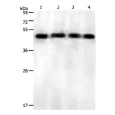 KISS1R Antibody from Signalway Antibody (31213) - Antibodies.com