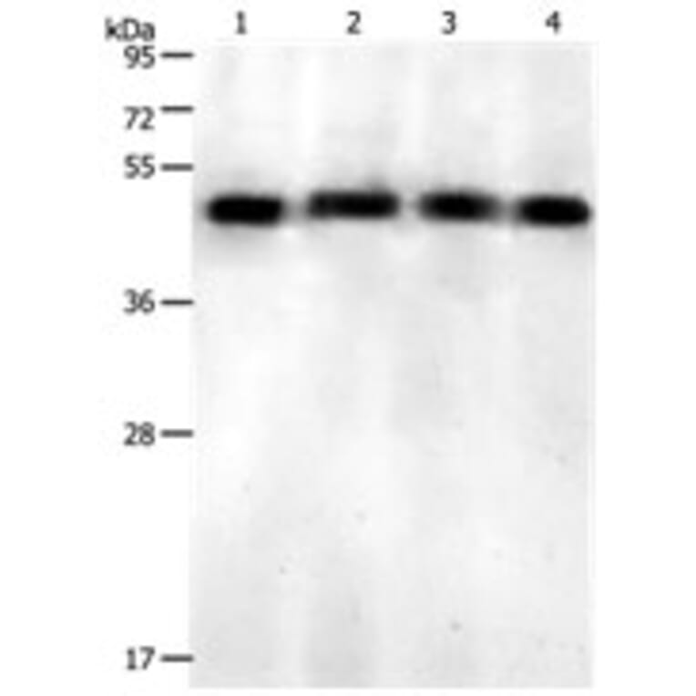 KISS1R Antibody from Signalway Antibody (31213) - Antibodies.com