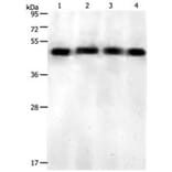 KISS1R Antibody from Signalway Antibody (31213) - Antibodies.com