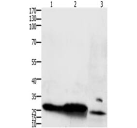 IL15RA Antibody from Signalway Antibody (31223) - Antibodies.com