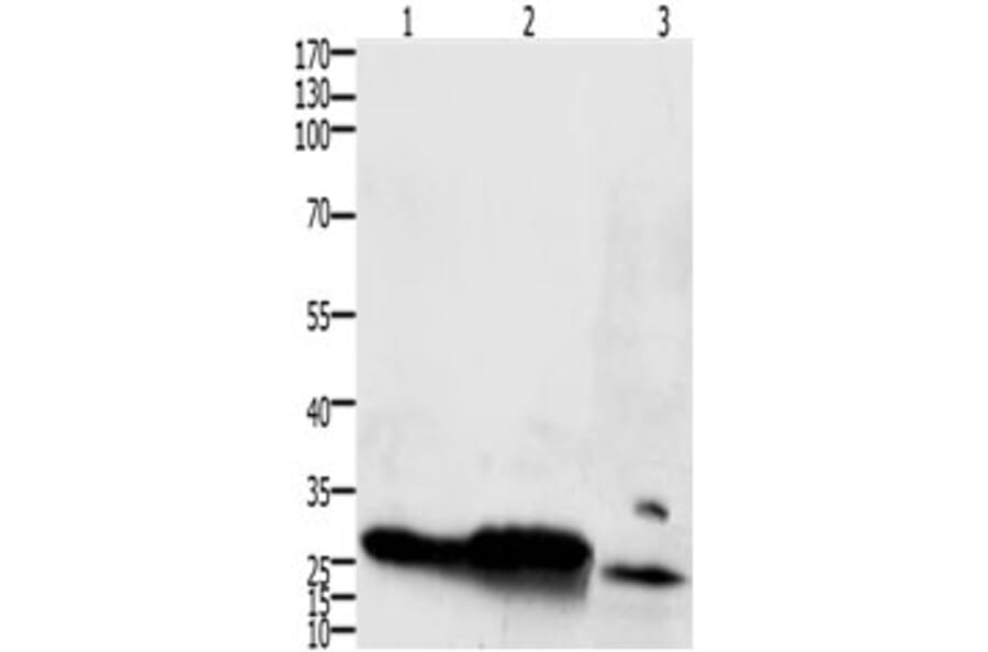 IL15RA Antibody from Signalway Antibody (31223) - Antibodies.com