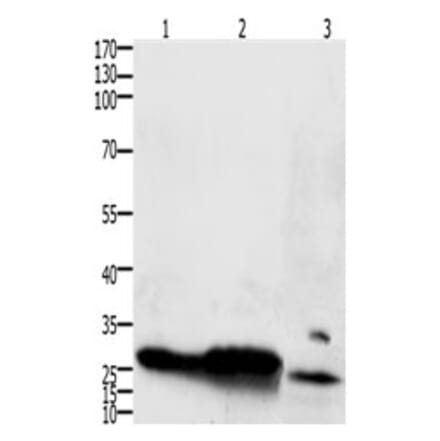 IL15RA Antibody from Signalway Antibody (31223) - Antibodies.com