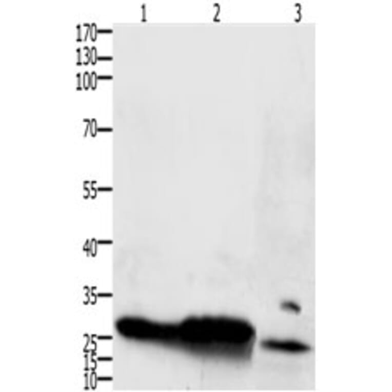IL15RA Antibody from Signalway Antibody (31223) - Antibodies.com