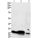 IL15RA Antibody from Signalway Antibody (31223) - Antibodies.com