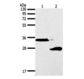 SFTPA1 Antibody from Signalway Antibody (31294) - Antibodies.com