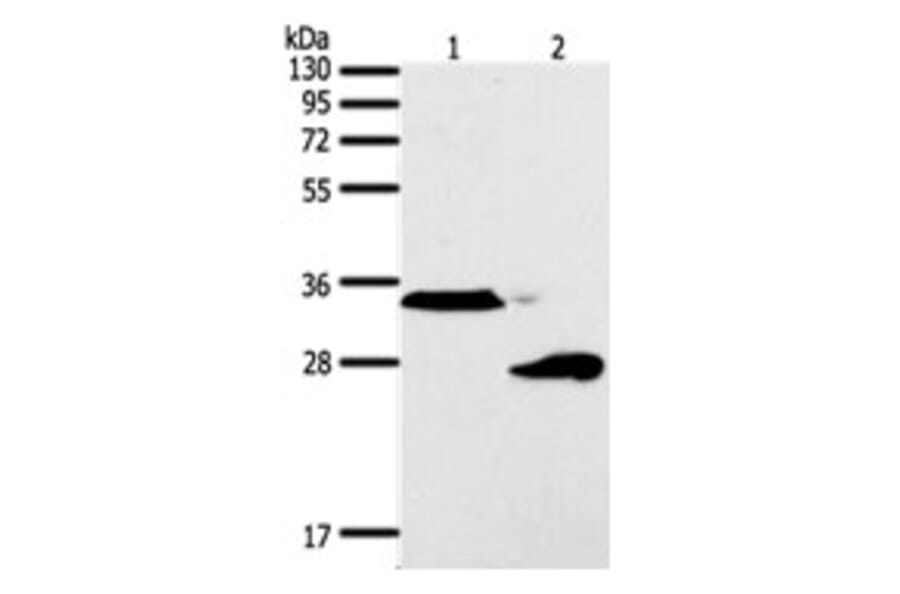 SFTPA1 Antibody from Signalway Antibody (31294) - Antibodies.com
