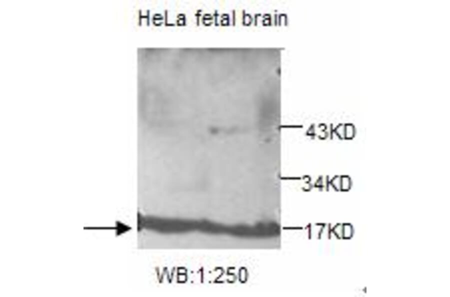 UBE2V2 Antibody from Signalway Antibody (39206) - Antibodies.com