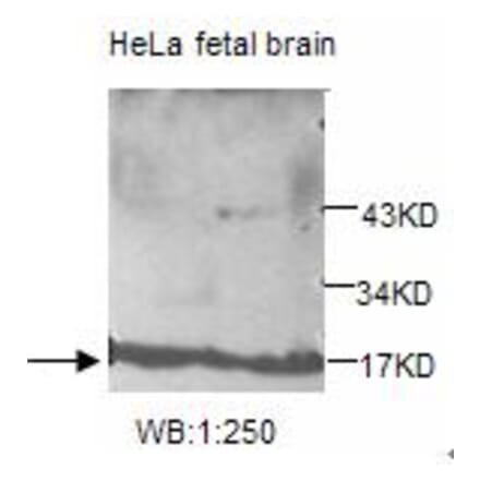 UBE2V2 Antibody from Signalway Antibody (39206) - Antibodies.com