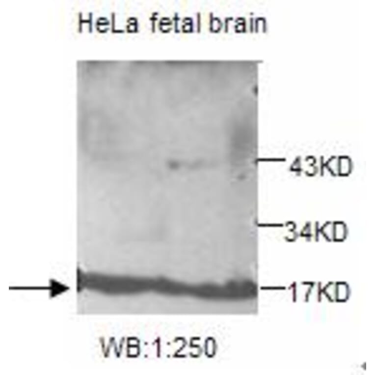 UBE2V2 Antibody from Signalway Antibody (39206) - Antibodies.com