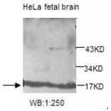 UBE2V2 Antibody from Signalway Antibody (39206) - Antibodies.com