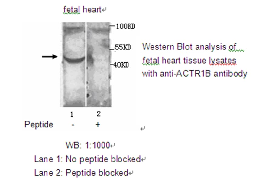 ACTR1B Antibody from Signalway Antibody (39208) - Antibodies.com