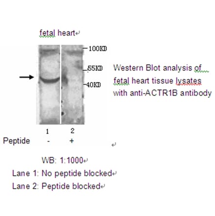 ACTR1B Antibody from Signalway Antibody (39208) - Antibodies.com