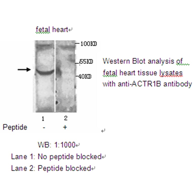 ACTR1B Antibody from Signalway Antibody (39208) - Antibodies.com