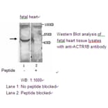 ACTR1B Antibody from Signalway Antibody (39208) - Antibodies.com