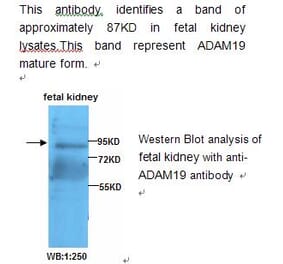 ADAM19 Antibody from Signalway Antibody (39209) - Antibodies.com