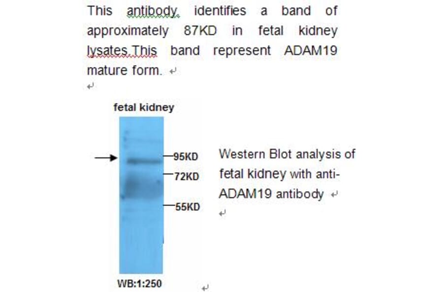 ADAM19 Antibody from Signalway Antibody (39209) - Antibodies.com