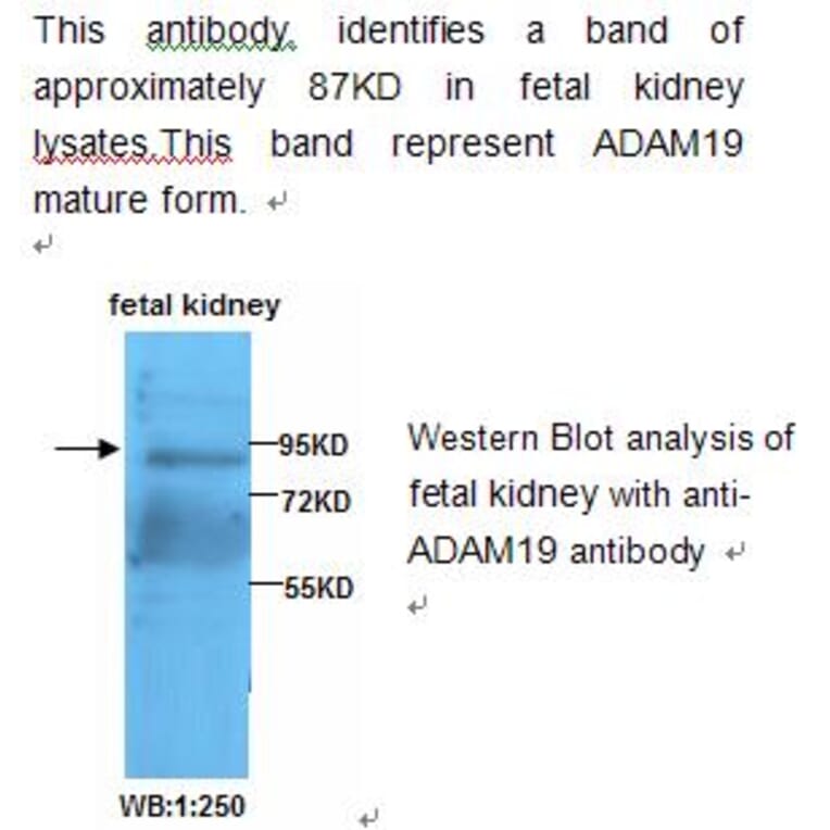 ADAM19 Antibody from Signalway Antibody (39209) - Antibodies.com